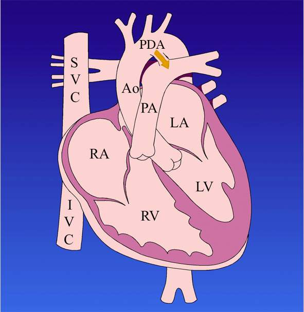 Simplified diagram of the human heart. See aria