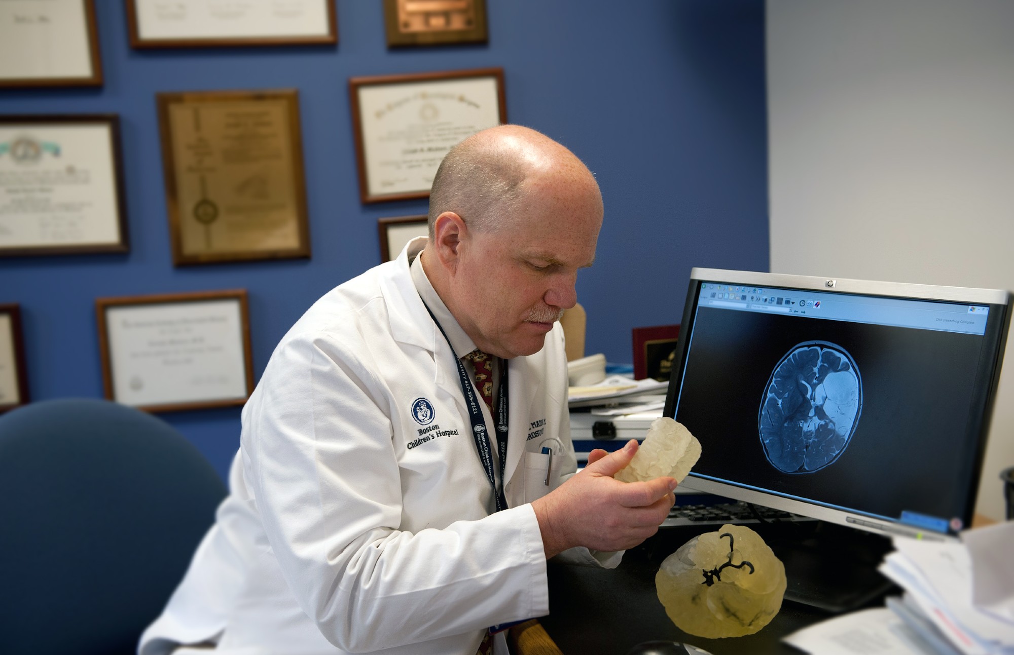 A man looks at a 3D image of a brain.