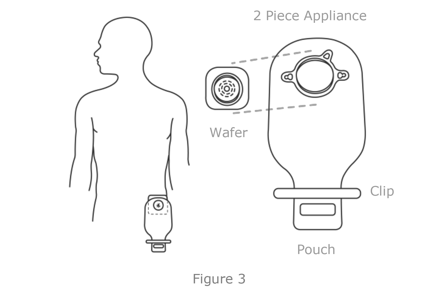 An ostomy pouch or bag that collects stool. The pouch is a 2-piece appliance that consists of water and a clip.