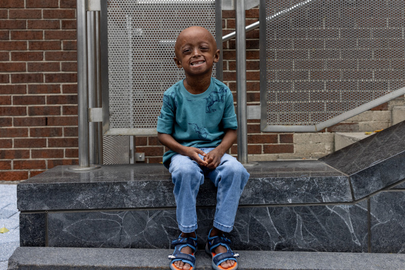 6-year-old child with progeria sits on step in front of building