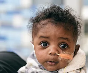 Baby with tube in nose stares at camera