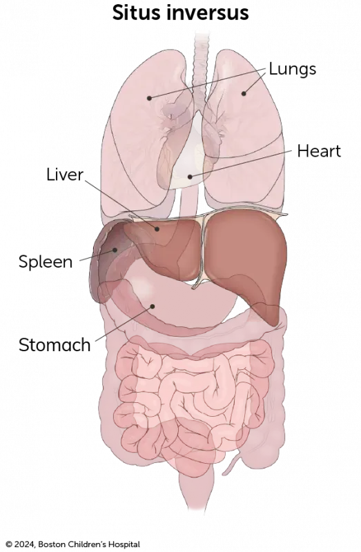 An illustration shows the reverse of a normal chest and abdominal anatomy.