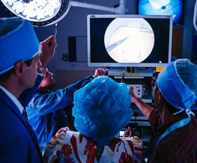 Four clinicians gather around a monitor to look at surgery imagery