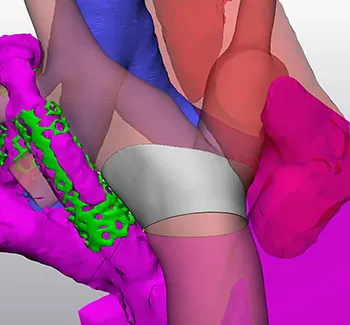 Illustration of cardiac surgery innovations
